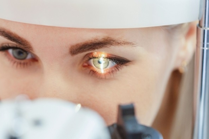 blog image opticians